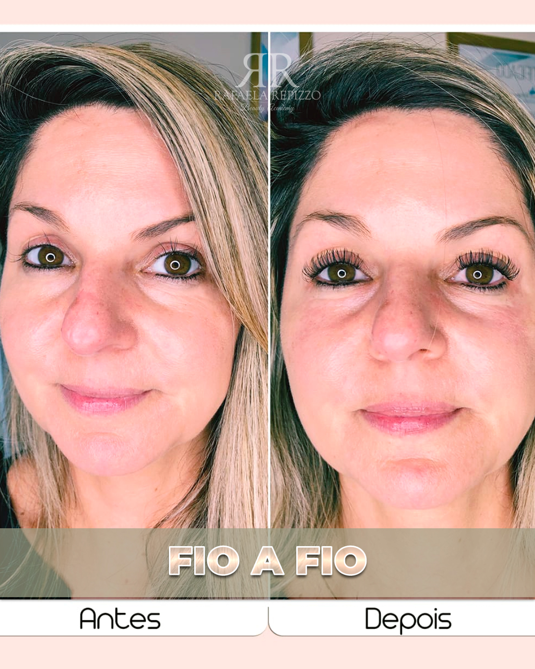 01_Fio a Fio_00